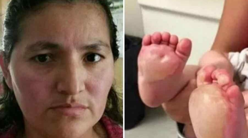 TRISTEZA: Babá se irrita com choro de criança de 2 meses e queima o pé com ferro elétrico.