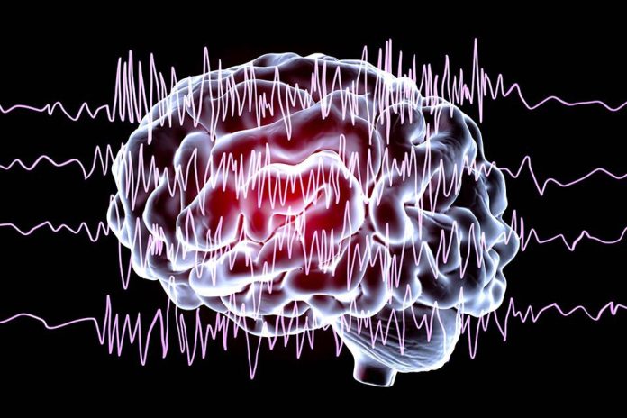 Epilepsia: saiba reconhecer sintomas e como agir durante uma crise