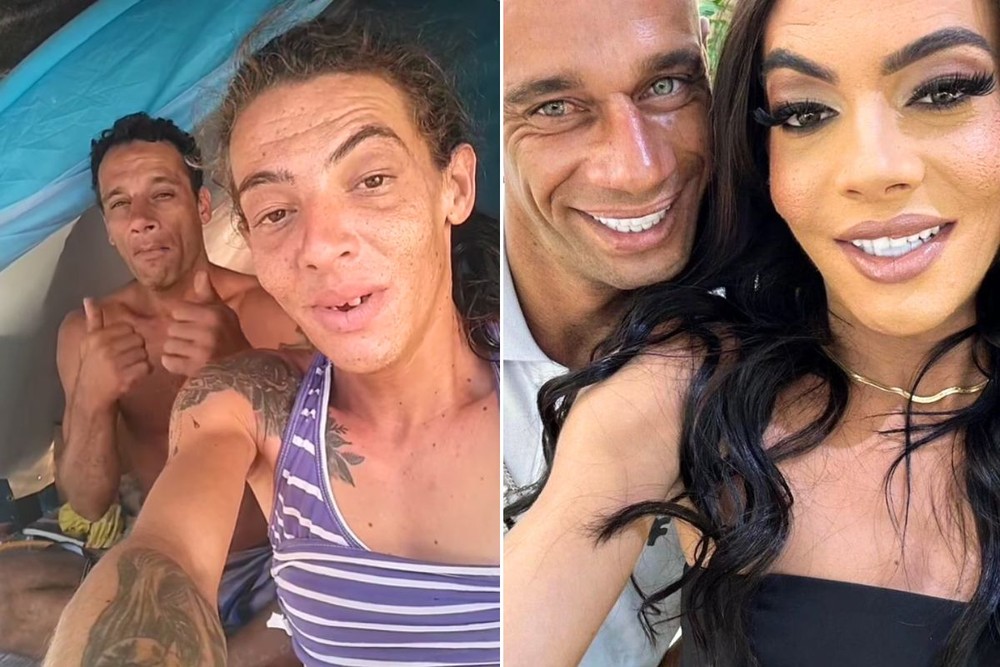 Casal ‘maloka’ que viralizou mostrando vida nas ruas comemora sorriso novo; veja antes e depois